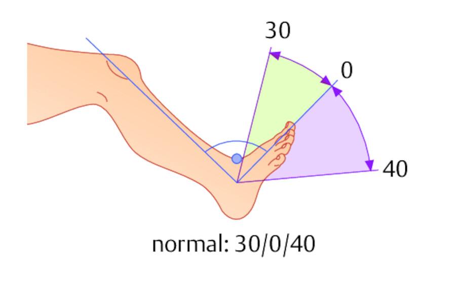 Normalerweise ist eine Fußhebung im OSG um 30° möglich, eine Fußsenkung um 40°.