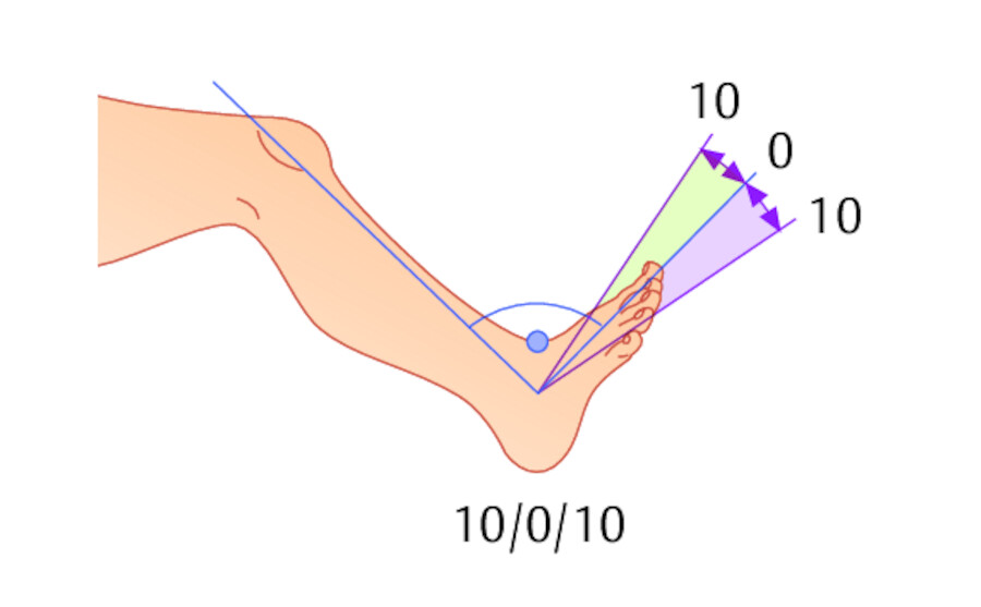 Fußhebung und Fußsenkung sind auf je 10° beschränkt.