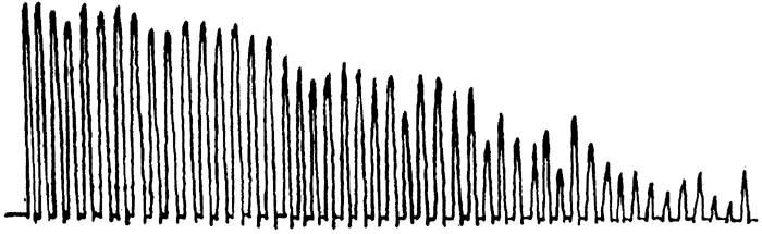 Fig. 2: Ergogram of C.E., a weak and somewhat nervous girl, before taking 40 minutes' work in the gymnasium