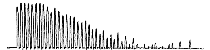 Fig. 3: Ergogram of C.E. after taking 40 minutes' work in the gymnasium, showing that the exercise proved very exhausting.