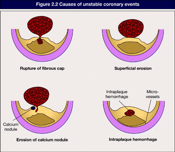 A978-1-84800-358-3_2_Fig2_HTML.jpg