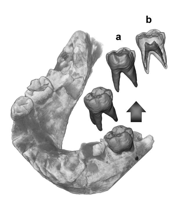 FIG 8.3 Estrazione e dissezione virtuale di un molare da latte di un bambino di Neanderthal, ottenuta con la microtomografia ai raggi X: a) smalto in trasparenza, per mostrare la struttura interna del dente (dentina); b) smalto e dentina in trasparenza, per mostrare la camera pulpare. (Tuniz et al., 2012)