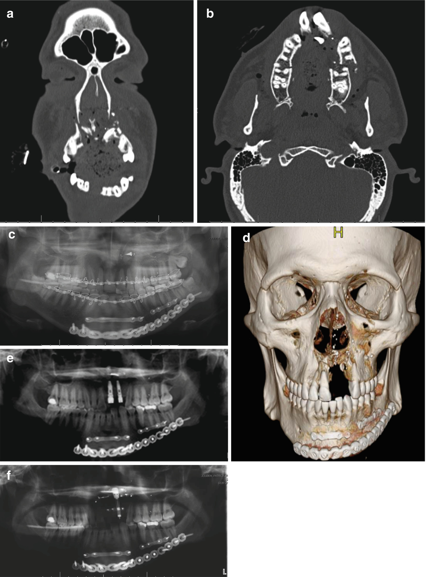 ../images/416818_1_En_6_Chapter/416818_1_En_6_Fig1a_HTML.png