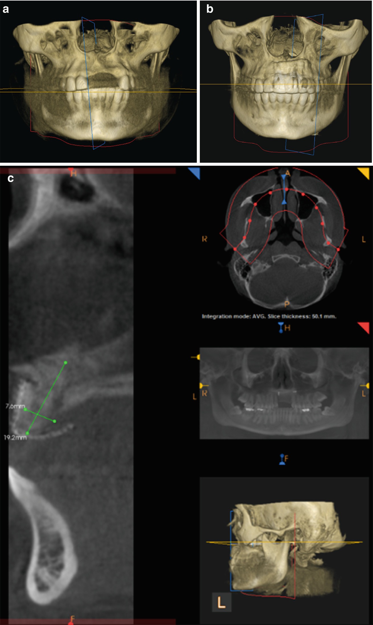 ../images/416818_1_En_6_Chapter/416818_1_En_6_Fig3a_HTML.jpg