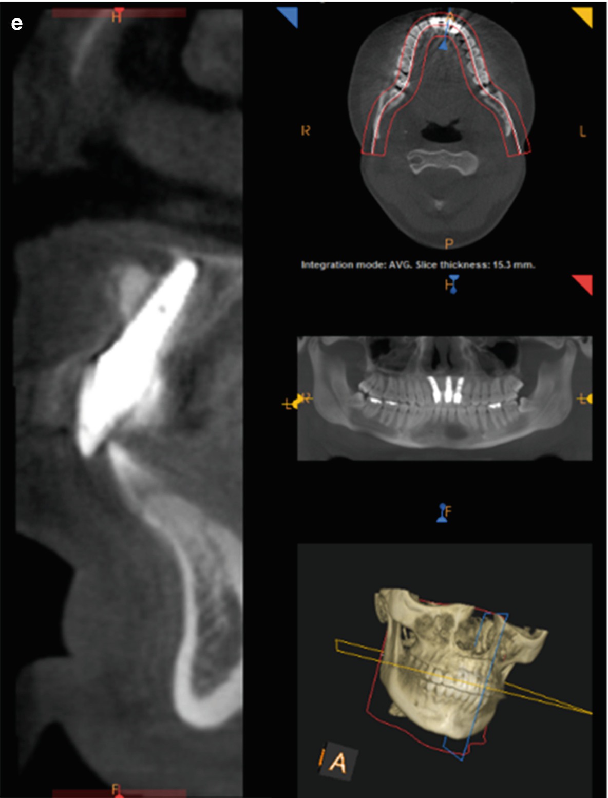 ../images/416818_1_En_6_Chapter/416818_1_En_6_Fig3c_HTML.jpg