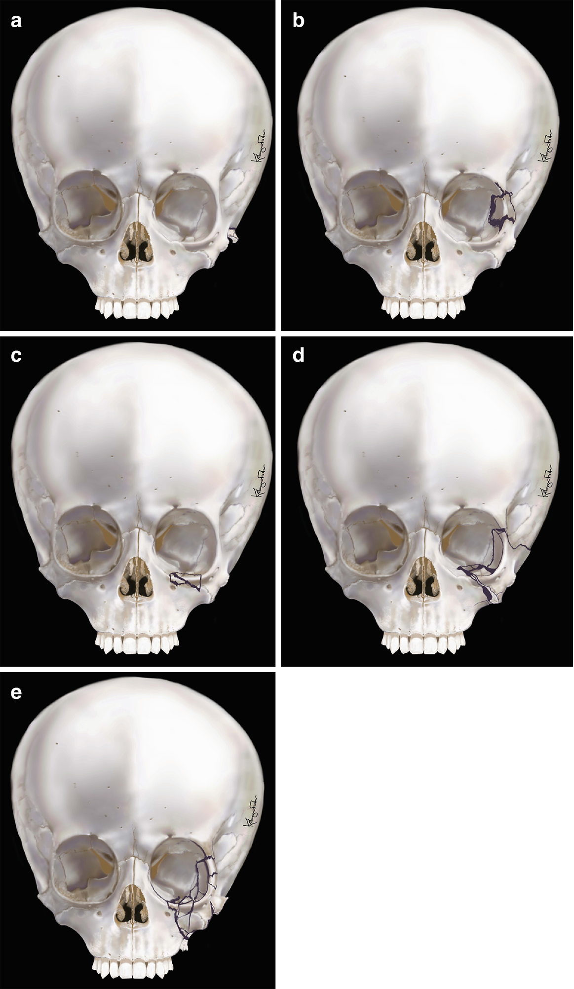 ../images/416818_1_En_8_Chapter/416818_1_En_8_Fig12_HTML.png