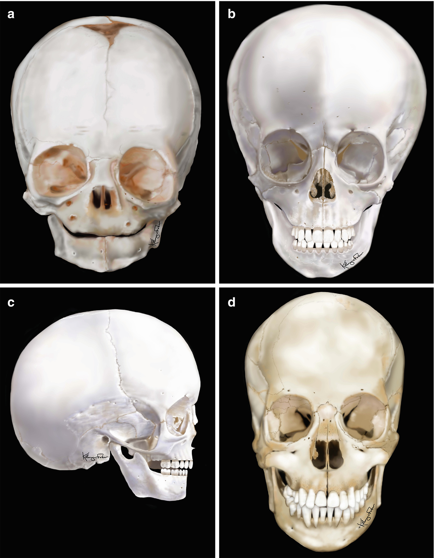 ../images/416818_1_En_8_Chapter/416818_1_En_8_Fig2_HTML.png