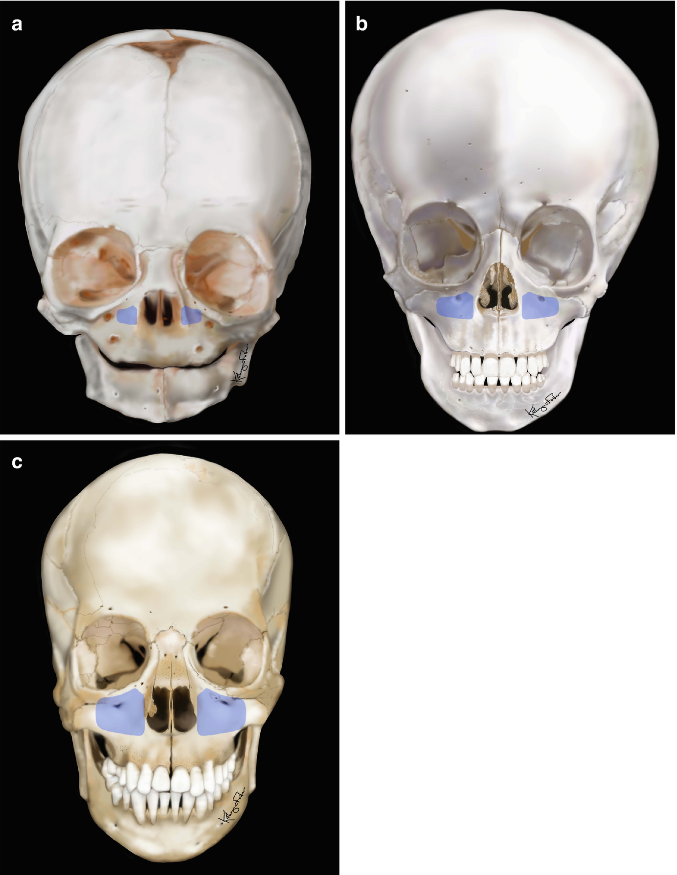 ../images/416818_1_En_8_Chapter/416818_1_En_8_Fig4_HTML.png