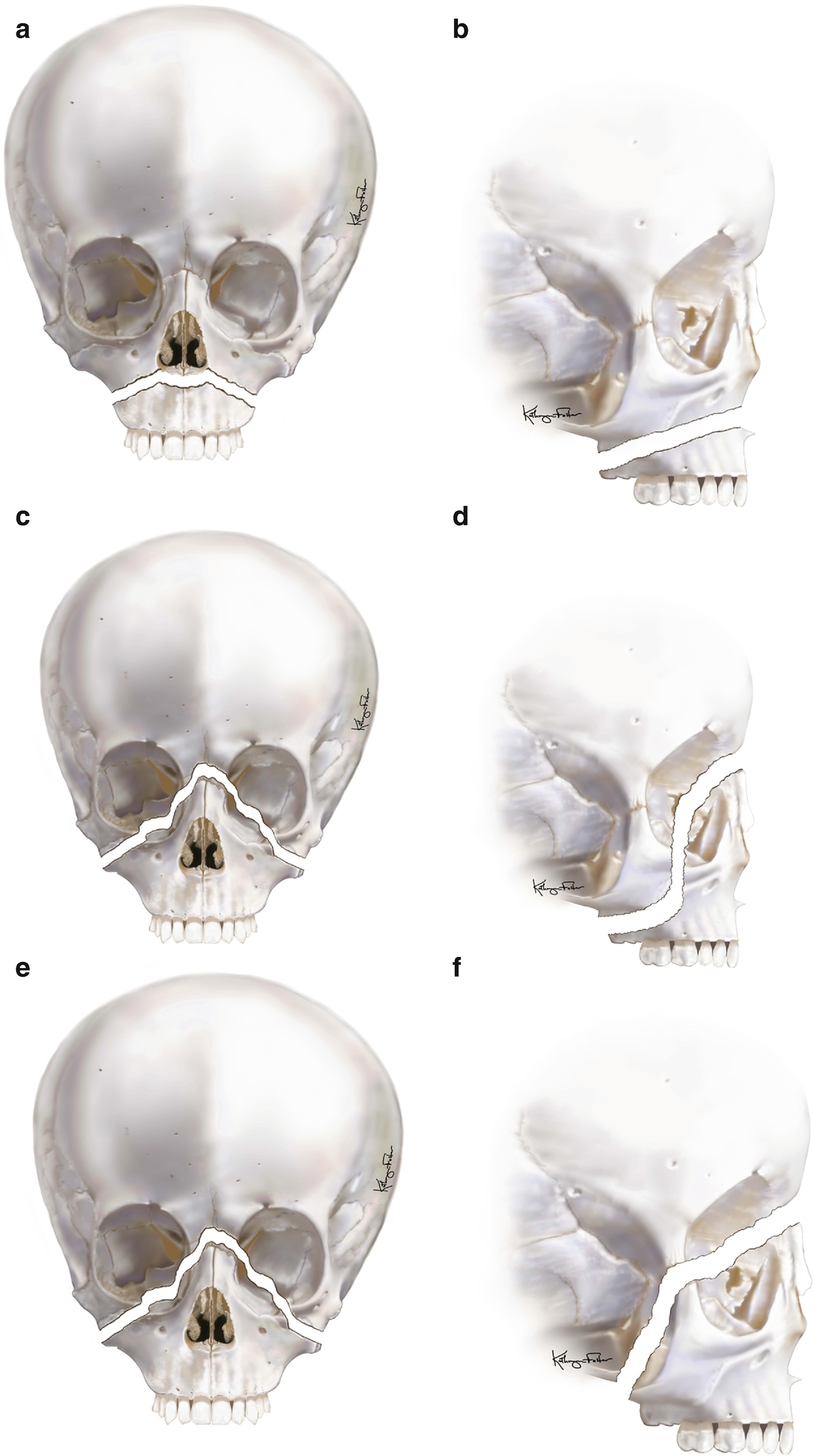 ../images/416818_1_En_8_Chapter/416818_1_En_8_Fig7_HTML.png