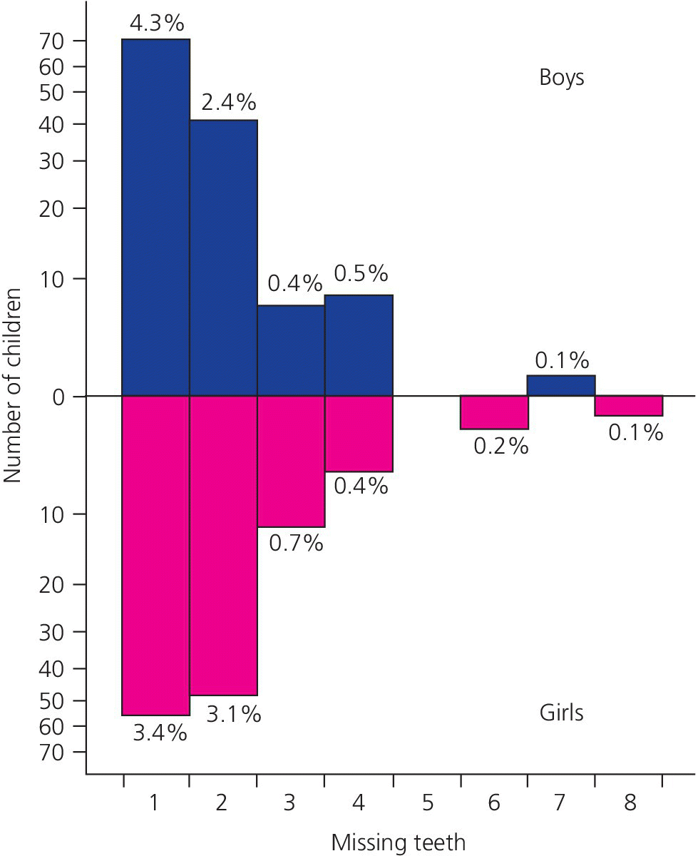 Back to back histogram of number of children vs. number of missing teeth for boys and girls, with values in percentages.