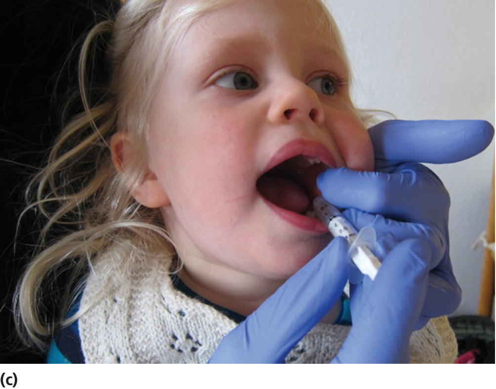 Photo displaying a young child with a needleless syringe placed in her mouth.