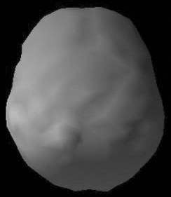 Surface SPECT scan showing uniform blood flow.