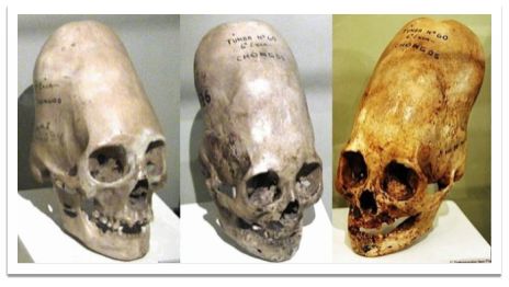 paracas_skulls