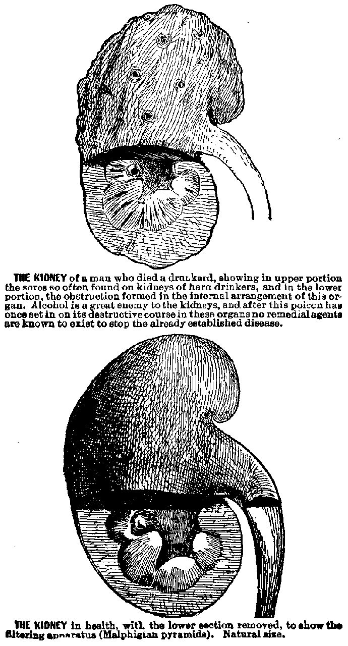 Line Drawing of Two Kidneys