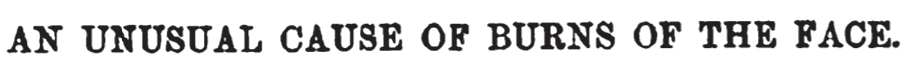 An unusual cause of burns of the face. 