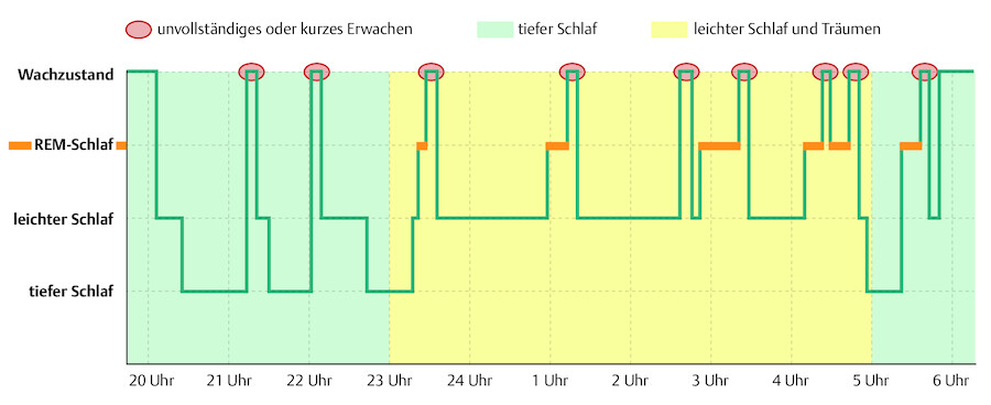 Das Schlafmuster von Kindern.