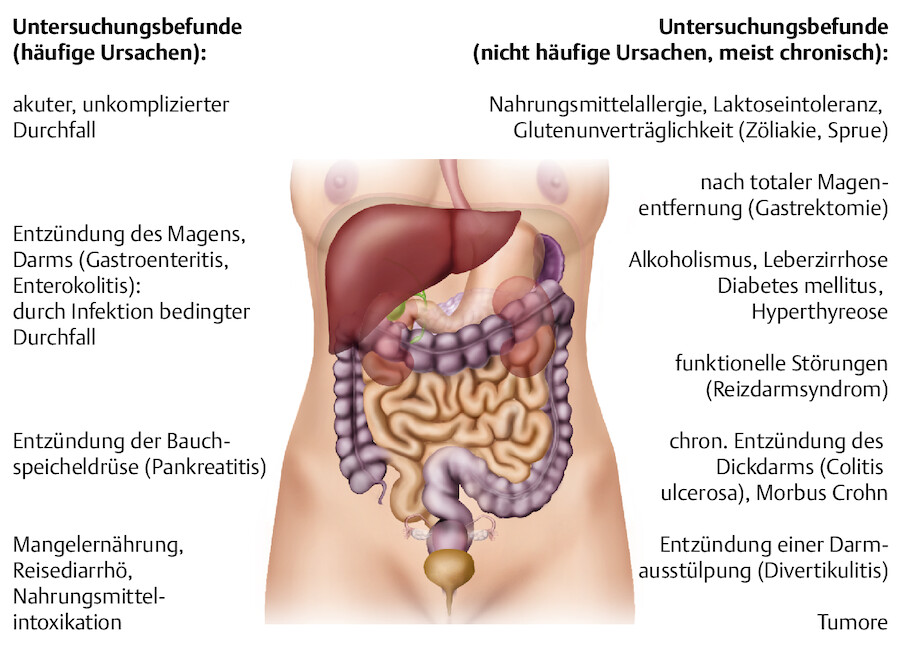 Ursachen von Durchfall (Diarrhö).