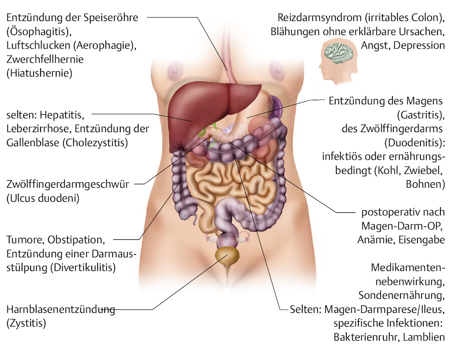 Ursachen von Blähungen (nach Sandholzer 2007).