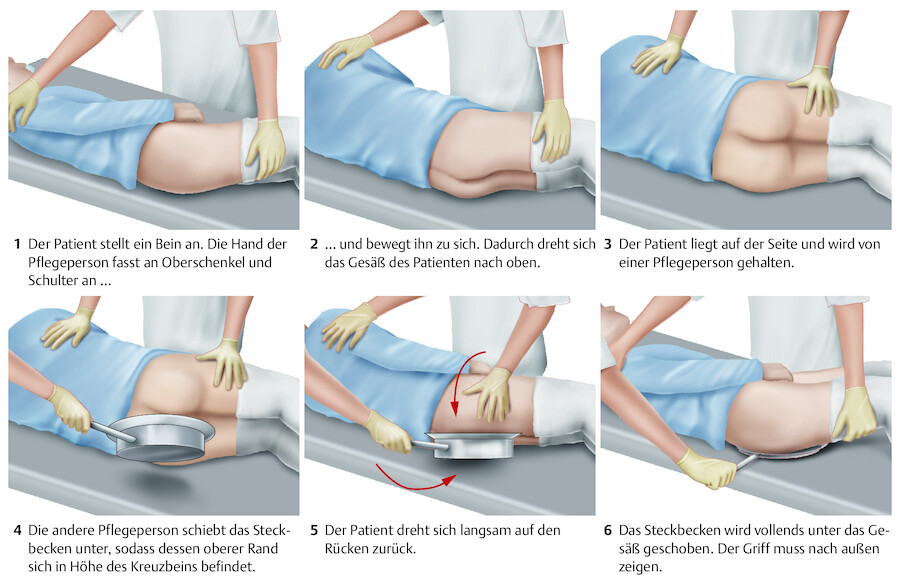 Unterschieben des Steckbeckens durch 2 Pflegepersonen.