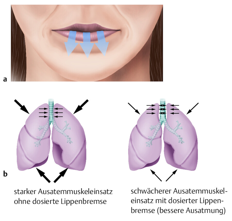 Lippenbremse.