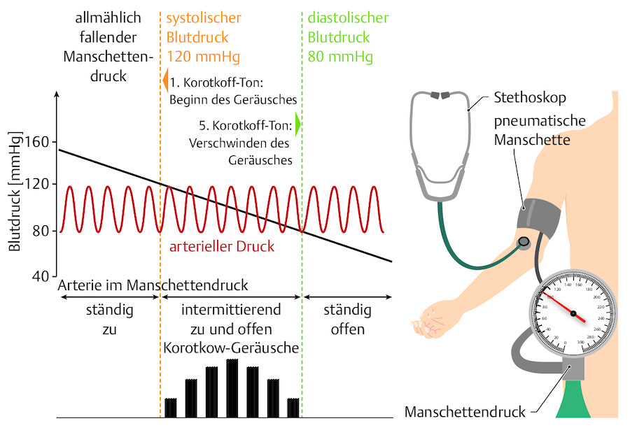 Prinzipien der Blutdruckmessung.