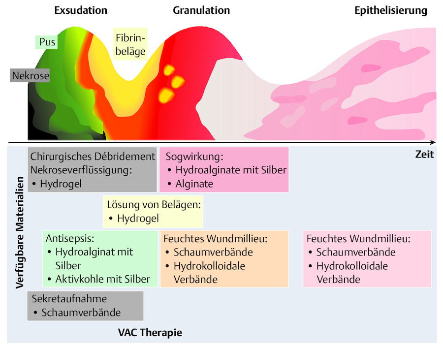 Phasengerechte Wundversorgung chronischer Wunden.