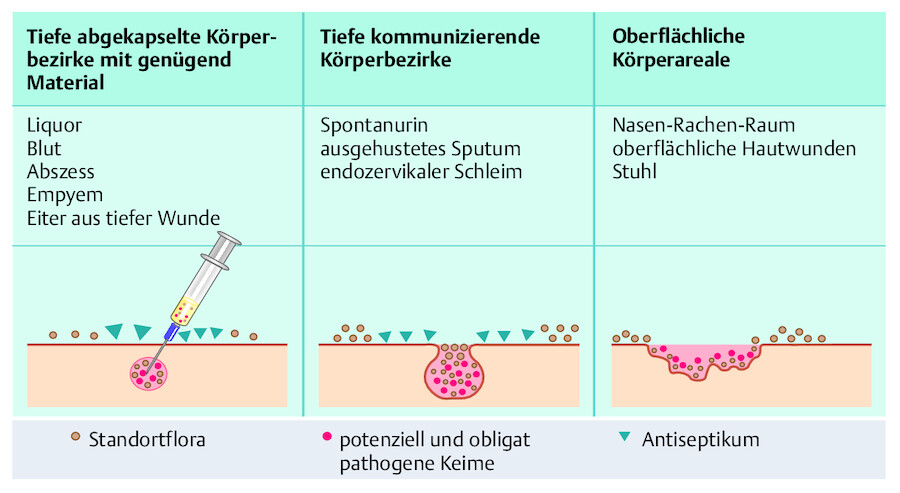 Gewinnung von Untersuchungsmaterial von verschiedenen Körperarealen (nach Sitzmann 1999).