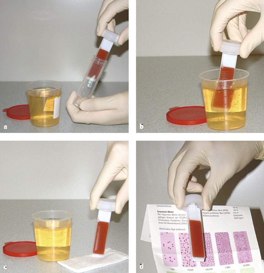 Durchführung des Uricult-Tests.