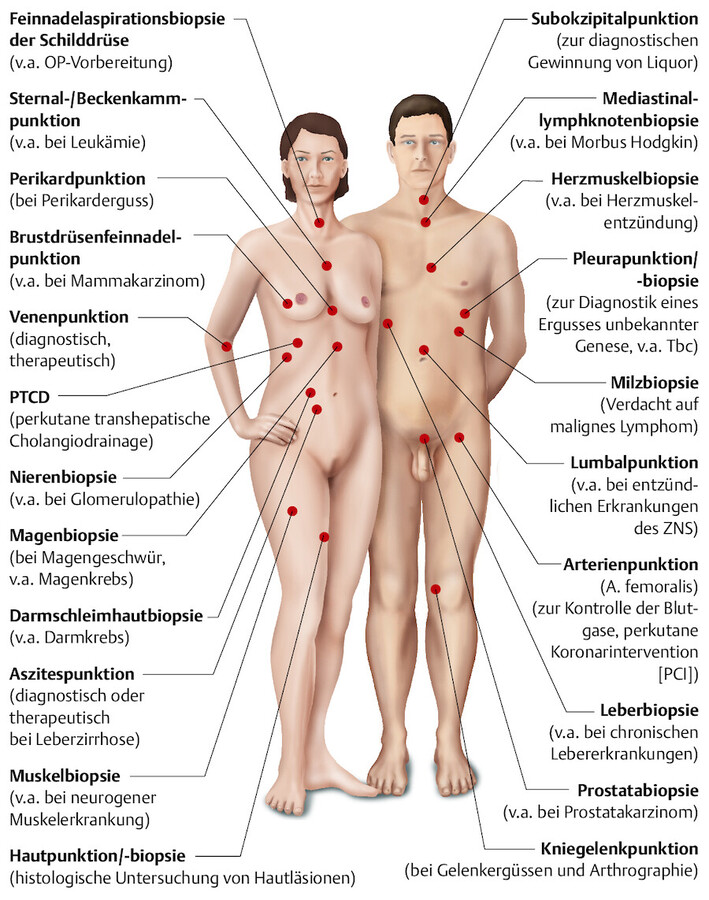 Übersicht über die wichtigsten Punktionen und Biopsien.