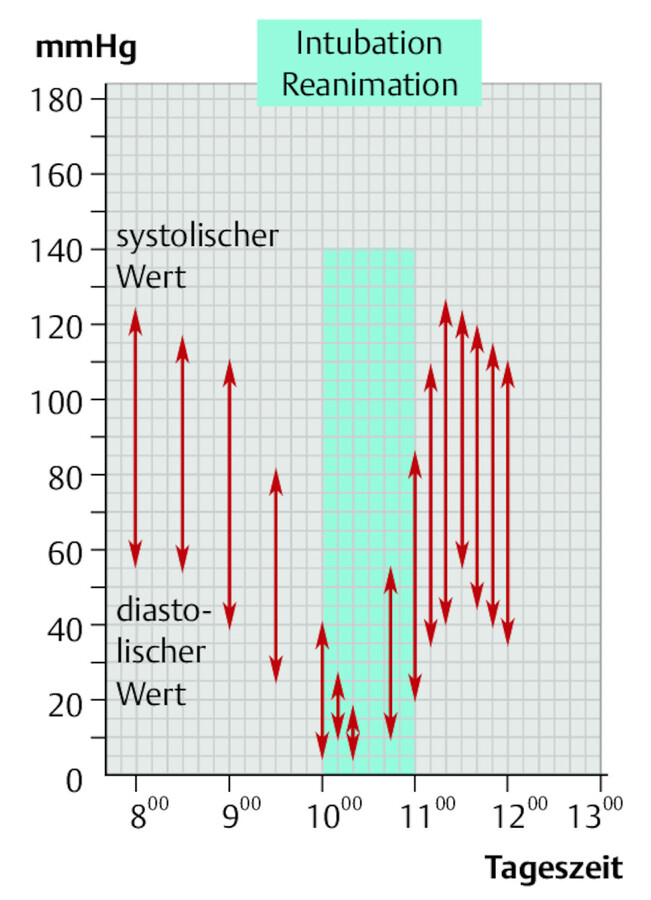 Grafische Dokumentation des Blutdrucks.