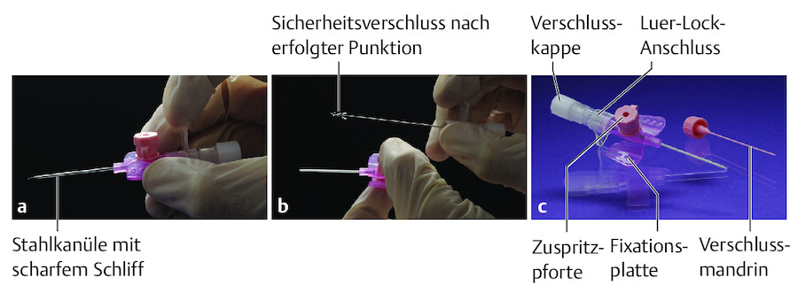 Sicherheitsvenenverweilkanüle mit Luer-Lock-Anschluss.