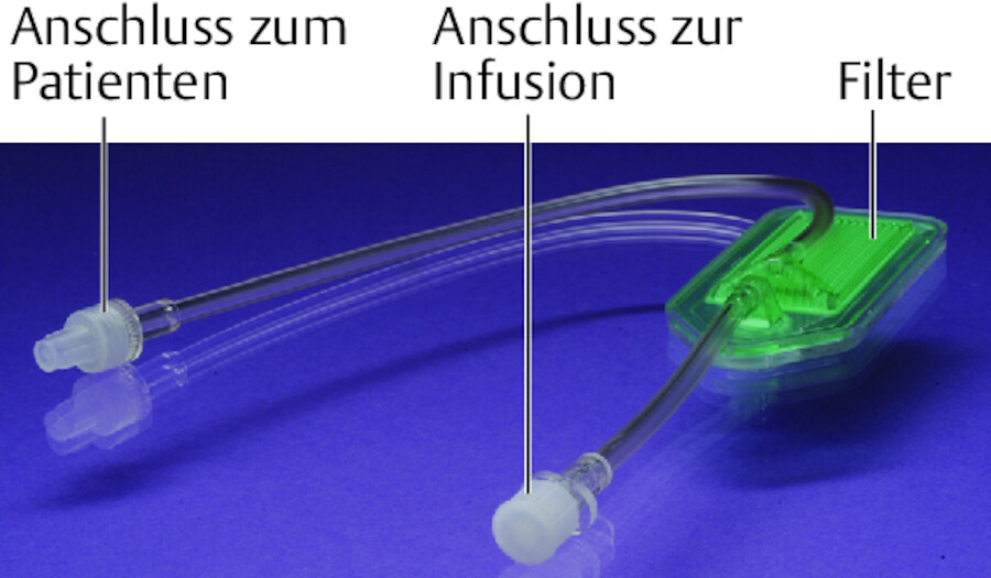 Formen von Infusionsfiltern mit 3-Wege-Hahn-System.