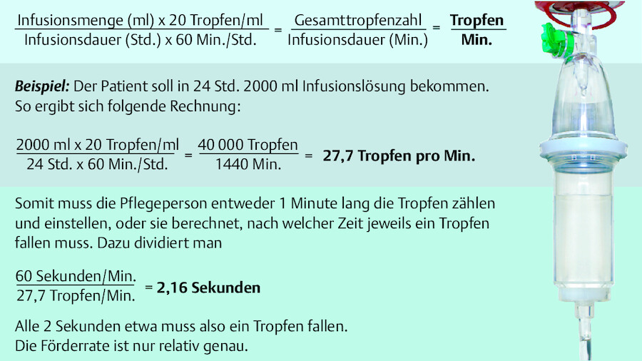 Formel zur Berechnung der Tropfgeschwindigkeit bei schwerkraftgesteuerten Infusionen.