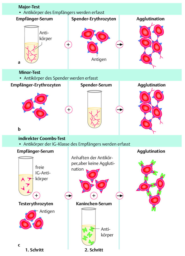 3-Stufen-Test.