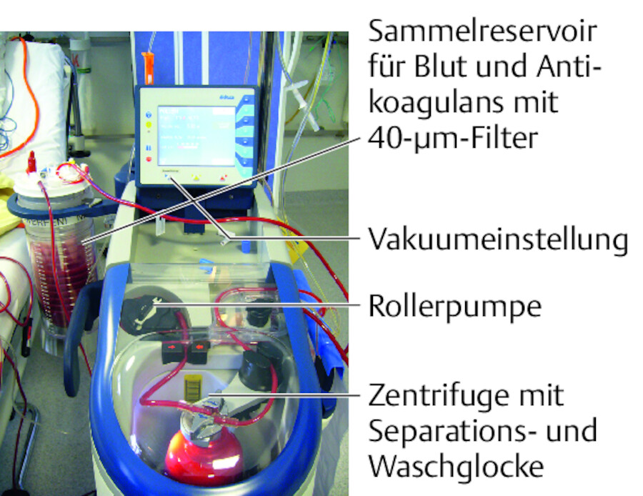 Cell-Saver zur autologen Bluttransfusion,