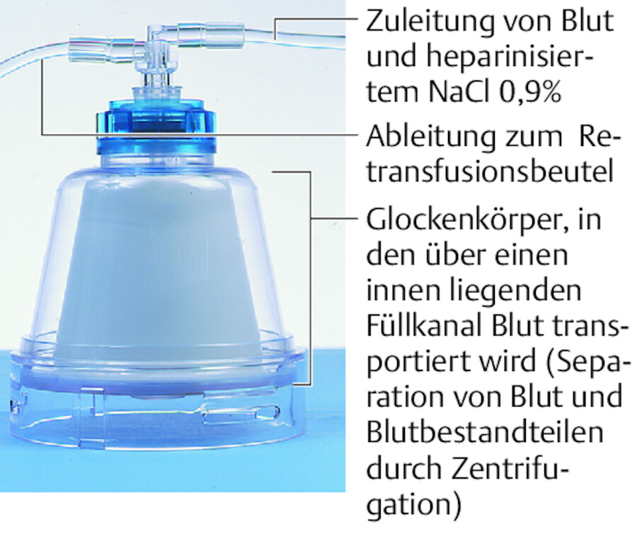 Separations- und Waschglocke der Zentrifuge.