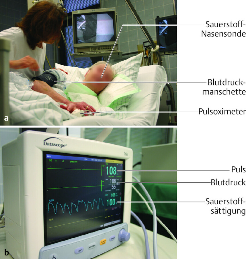 Zur Überwachung werden Puls, Blutdruck und Sauerstoffsättigung gemessen.