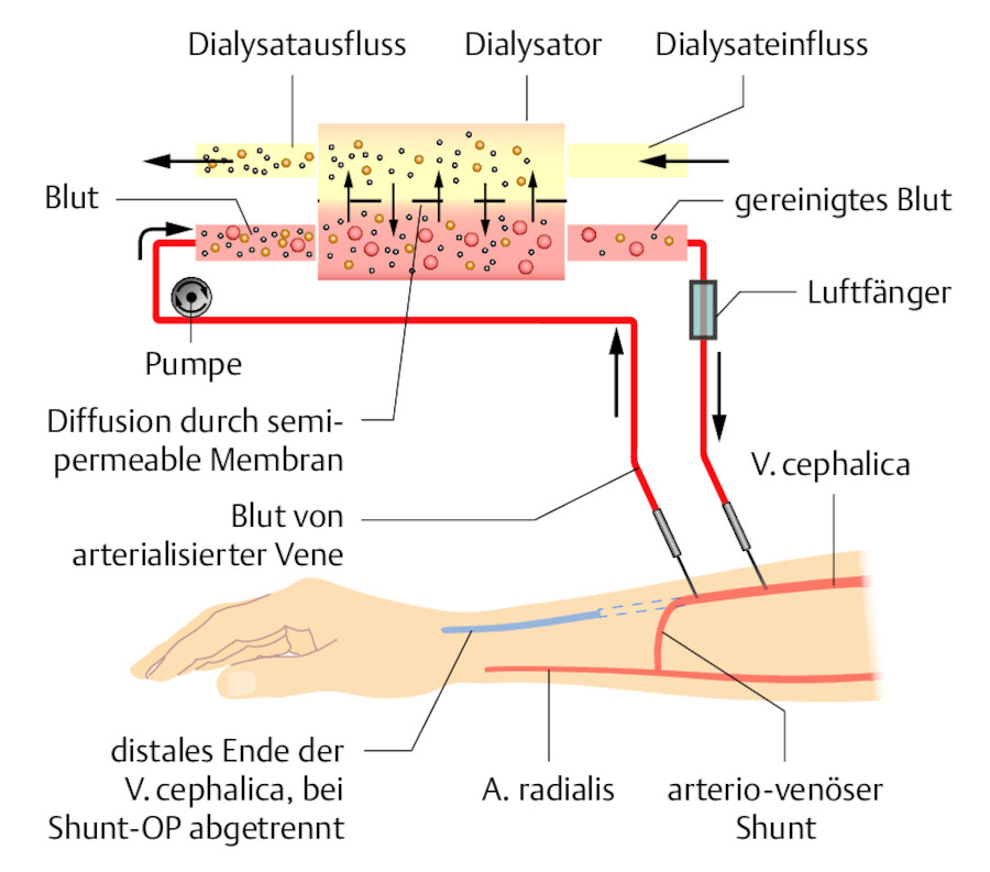 Schema des extrakorporalen Blutkreislaufs.