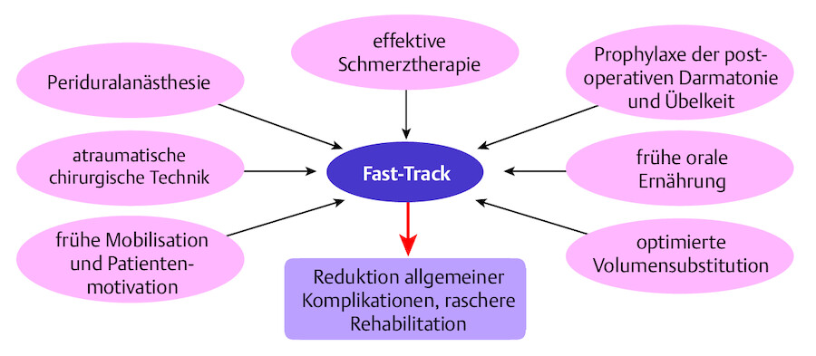 Behandlungskonzept der „Fast-Track-Rehabilitation bei Kolonresektionen.