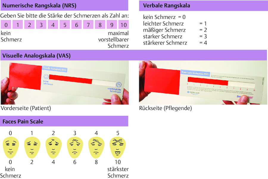 Verschiedene Skalen zur Erfassung von Schmerzen.