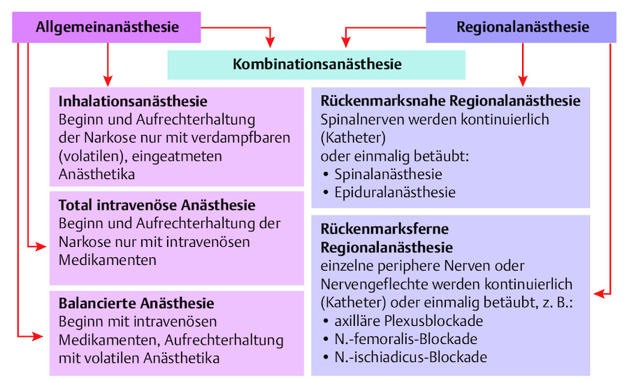 Übersicht über die verschiedenen Anästhesieverfahren.