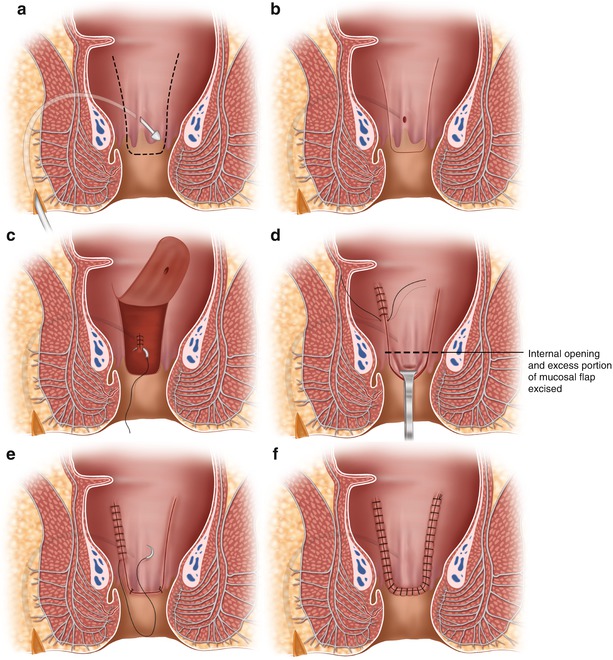 A78566_3_En_48_Fig20_HTML.jpg