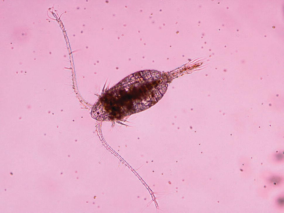 Micrograph displaying a female calanoid copepod.