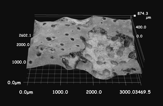 4-19 Lichen Surface 100X