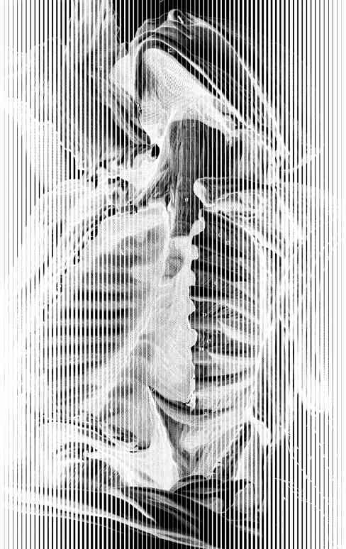 Anatomical illustration from The Anatomy of Humane Bodies (1737) by William Cowper