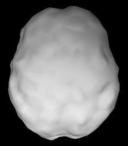 Surface SPECT scan showing uniform blood flow.