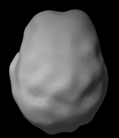 Surface SPECT scan showing mostly uniform blood flow.