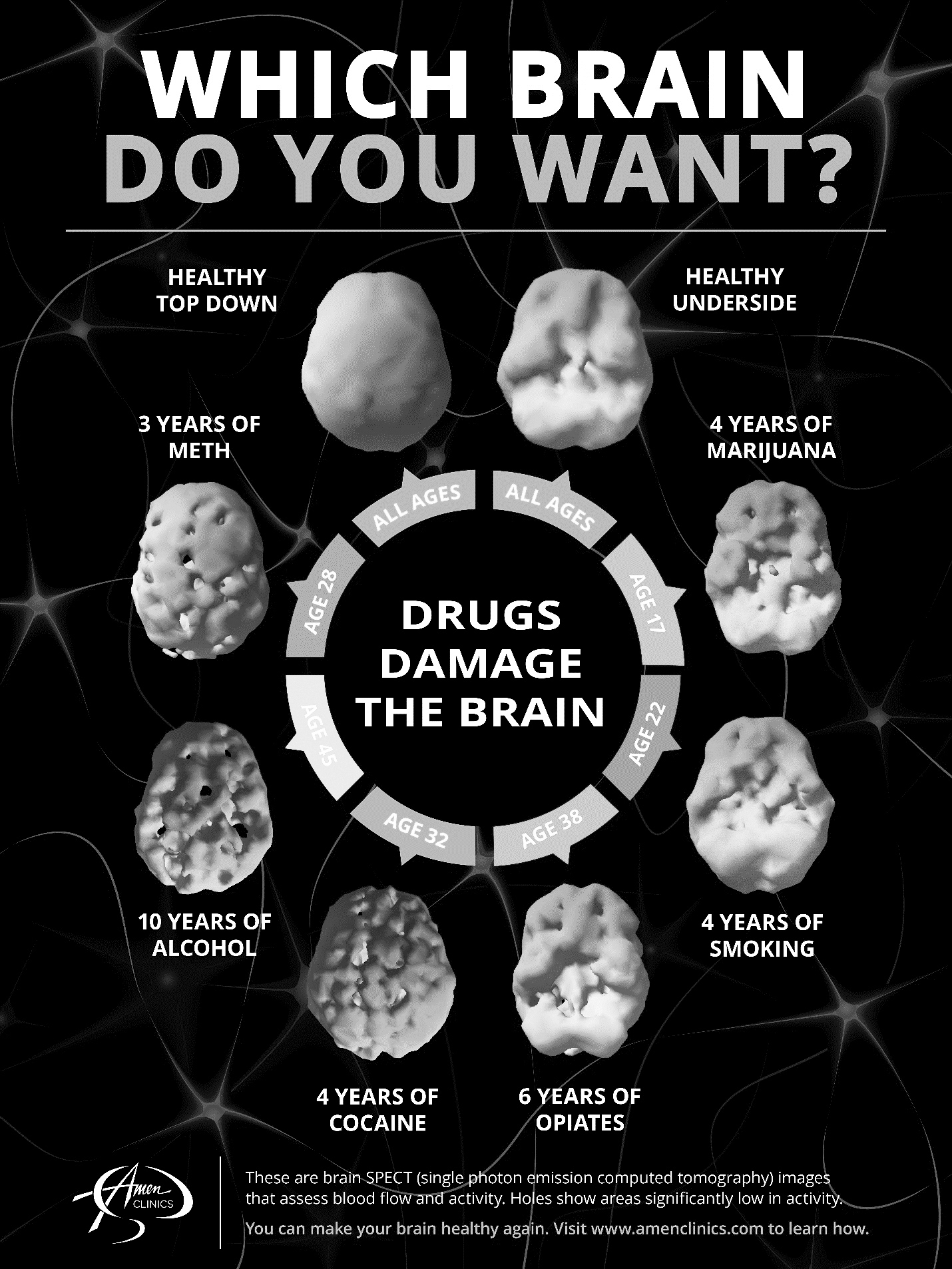 Diagram titled 'Which Brain Do You Want?' SPECT scans are arranged in a circle around the message 'Drugs damage the brain.' At the top left is a healthy top down view. To its right is a healthy underside view. The other scans show many holes in brain activity. Clockwise from the healthy brains are brains with 4 years of marijuana at age 17, 4 years of smoking at age 22, 6 years of opiates at age 38, 4 years of cocaine at age 32, 10 years of alcohol at age 45, and 3 years of meth at age 28. An explanation at the bottom of the poster says, 'These are brain SPECT (single photon emission computed tomography) images that assess blood flow and activity. Holes show areas significantly low in activity. You can make your brain healthy again. Visit www.amenclinics.com to learn how.'