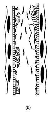 Figure 10 Mucosa of the upper respiratory pathways in normal condition (a) and dried out (b)