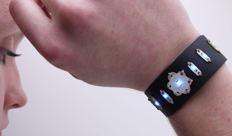 Aniomagic bracelet (image courtesy of Aniomagic)